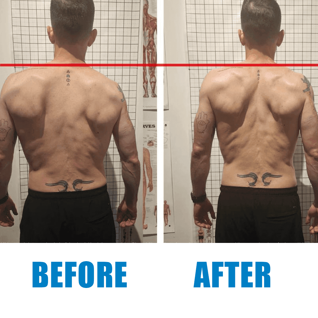Client posture before and after a Revolt Recovery session (1)