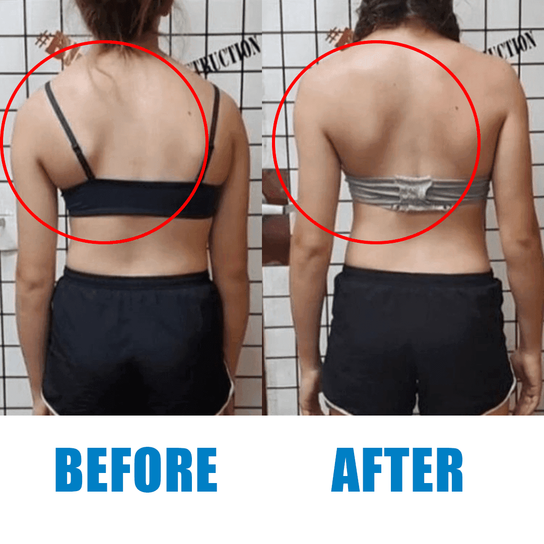 Client posture before and after a Revolt Recovery session (2)
