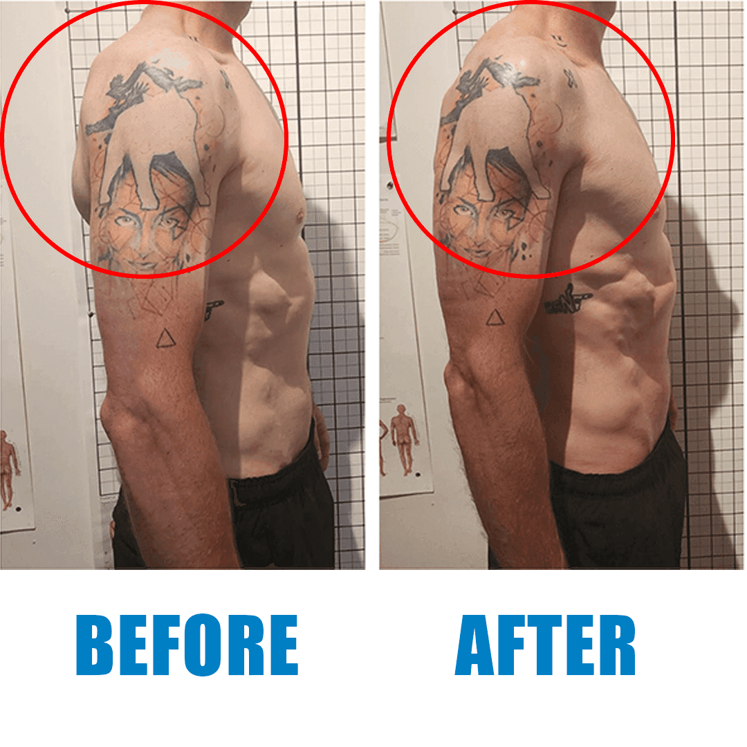 Client posture before and after a Revolt Recovery session (3)
